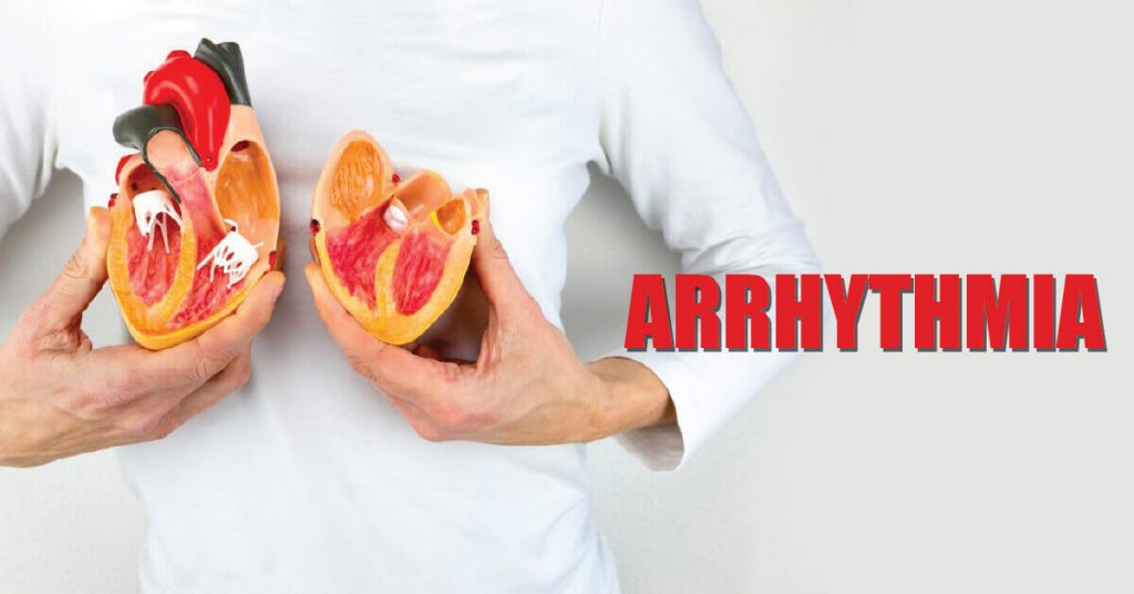 arrhythmia-sign.jpg