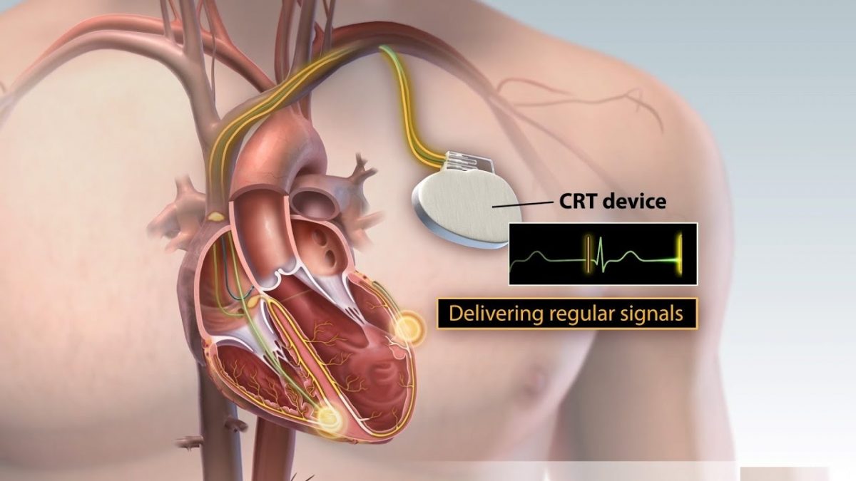 crt-therapy-by-dr-aparna-jaswal-1200x675.jpg