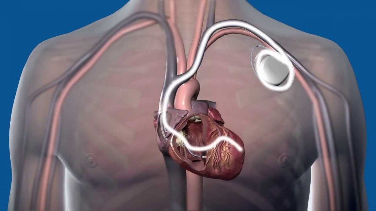 crt-treatment-by-dr-aparna-jaswal-1200x675.jpg